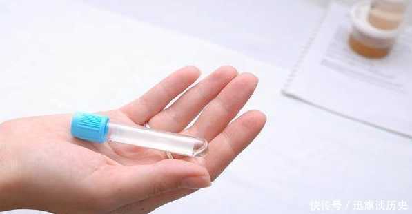 单身多囊卵巢患者如何选择医院？2026年最新医院排名与医生测评指南