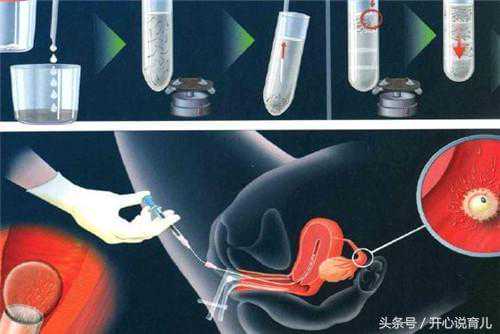 多囊试管卵子质量差怎么调理？真实失败案例与避坑指南